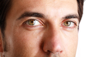 Male Blepharoplasty